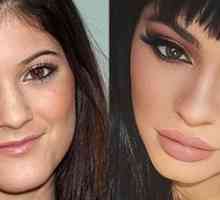 Kylie Jenner prije i nakon plastične