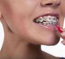 Kako četkati zube sa aparatića?