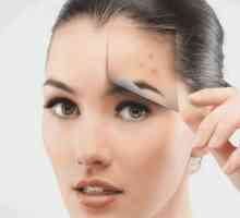 Kako da biste dobili osloboditi od pimples na čelo