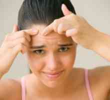 Kako da biste dobili osloboditi od acne na vaše lice tinejdžer?
