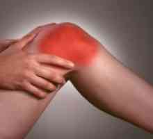 Kako liječiti osteoartritis koljena?