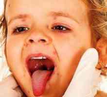 Kako liječiti hladno čireve u grlo djeteta?