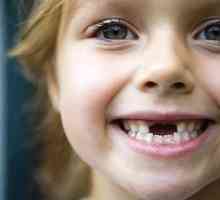 Kako promijeniti zube u djece