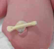 Kako se nositi pupka novorođenčeta s pin?