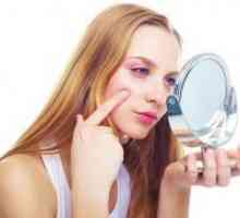 Kako čistiti lice akni?