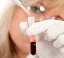 Kako odrediti krvnu grupu?