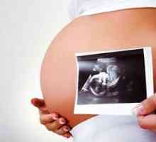 Kako prepoznati Downov sindrom u trudnoći