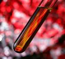 Kako smanjiti hemoglobina u krvi?