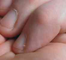 Kako ukloniti neravnine na prste?