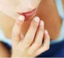 Kako izliječiti perleches na usnama?