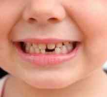Što su zubi ispasti u djece?