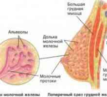 Karcinom dojke