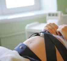 Fetalni ultrazvuk