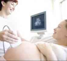 Kada se ultrazvuk u trudnoći?