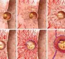 Kada implantacija embrija nakon ovulacije?