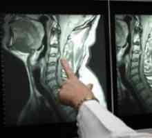 Kompjutorizirana tomografija kralježnice