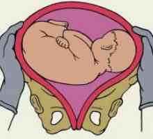 Kosom položaju fetusa
