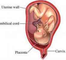 Granični placenta previa