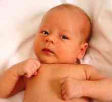 Tortikolis u djeteta 3 mjeseca - Simptomi