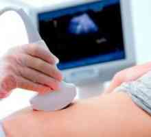 Laparoskopija uterine fibroids
