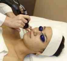 Laser je pokazao izvrsne rezultate u pomlađivanju kože