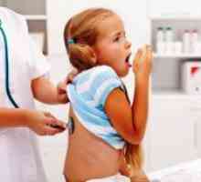 Tretman pertusis u djece