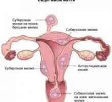 Maternice tijelo uterusa