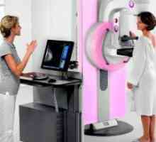 Mamografija - kada to učiniti?