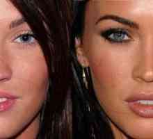 Megan Fox prije i poslije plastike