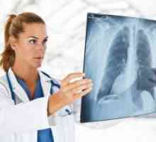 Miliary tuberkuloze