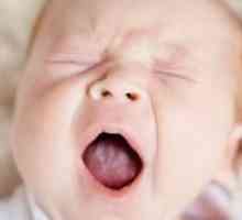 Kandidijaza u baby usta - nego liječiti?