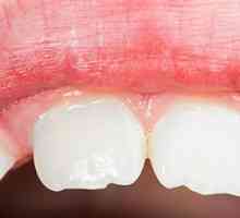 Mliječni zubi u djece
