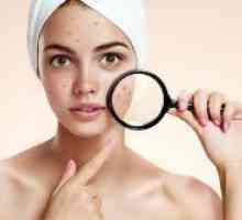 Je li moguće da obrišite lice s klorheksidin?