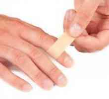 Apsces na prstu - Liječenje