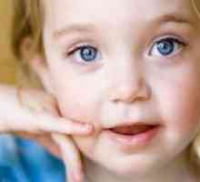 Neutropenija u djece