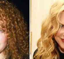 Nicole Kidman - i prije i poslije plastike