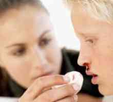 Krvarenja iz nosa kod djece - uzroci