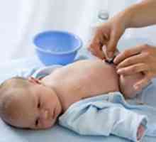 Liječenje pupčane rane dijete