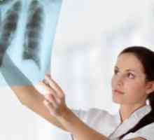 Žarišna plućna tuberkuloza