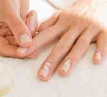 Onikomikoza noktiju - liječenje