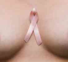 Onkologija dojke