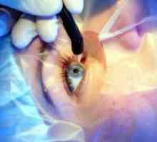 Korektivna kirurgija oka