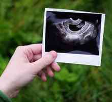 Utvrđivanje spol djeteta na ultrazvuku