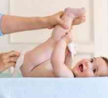 Pelenski osip kod beba: liječenje