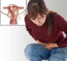 Tumor jajnika kod žena - liječenje