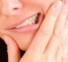 Akutni parodontitis