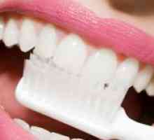 Izbjeljivanje zubi aktivni ugljen