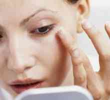 Otekline ispod očiju - uzroci i liječenje