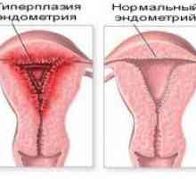 Endometrija patologija