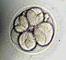 Prijenos embrija na dan 5
